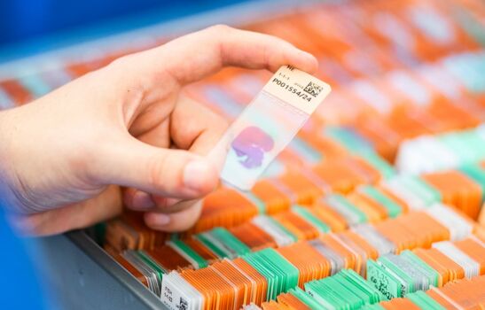 Gefärbter Gewebeschnitt Hand hält einen Mikroskopie-Objektträger mit Gewebeprobe aus einer Schublade, die mit farbcodierten Objektträgern geordnet ist.