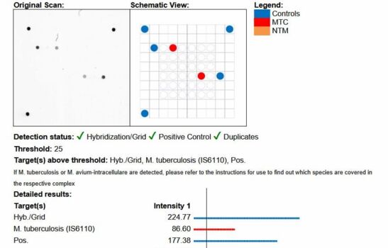 Statistik Vision Array