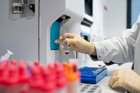 Eine Hand in gelbem Einweghandschuh hält ein Reagenzglas mit Blutprobe und führt es in ein Analysegerät ein. Im Vordergrund sind weitere Probenröhrchen zu sehen.