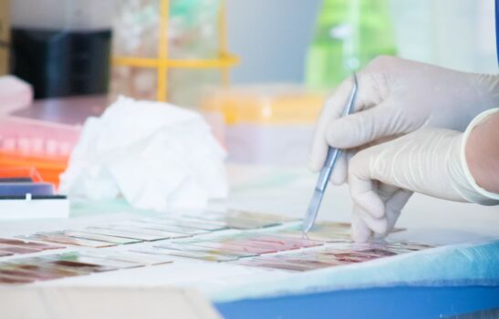 Hämatopathologie Lübeck - Labor mit modernen Technologien In dieser Nahaufnahme ist eine Labortätigkeit zu sehen. Eine Hand, angetan mit Schutzhandschuhen, hält eine Pinzette.