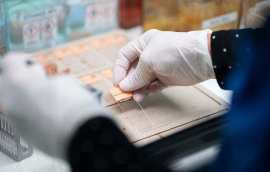Hand mit weißem Handschuh platziert einen beschrifteten Mikroskopie-Objektträger sorgfältig auf einer Arbeitsfläche im Labor.