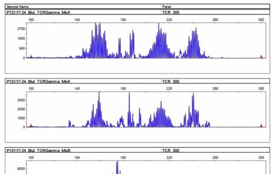 Vier Statistiken (Diagramme) zur Fragment-Analyse