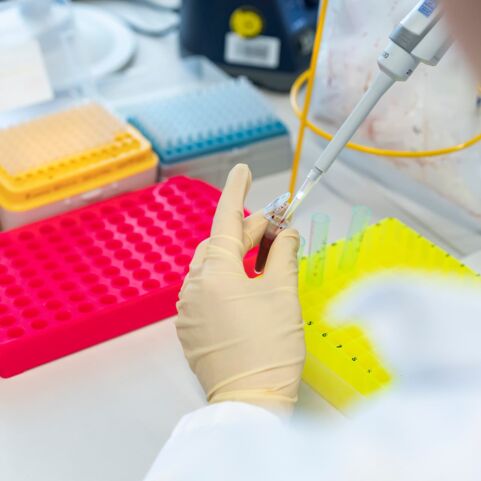 Vorbereiten der Proben Nahaufnahme einer Hand in Einweghandschuhen, die mit einer Pipette eine Blutprobe in ein Röhrchen füllt. Im Hintergrund sind farbige Laborutensilien zu sehen.